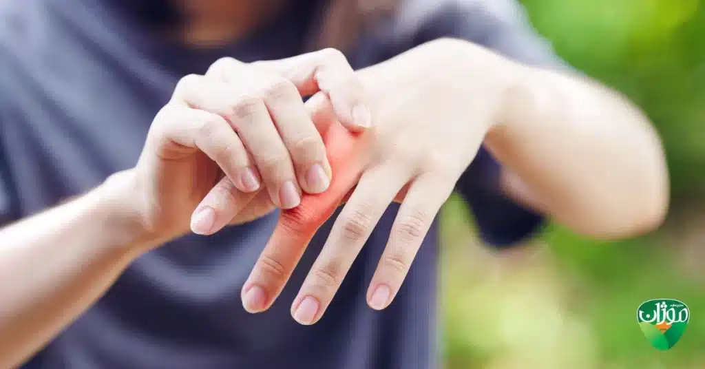 میوه‌های مفید برای کاهش علائم روماتیسم